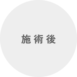 セッションの流れ　施術後